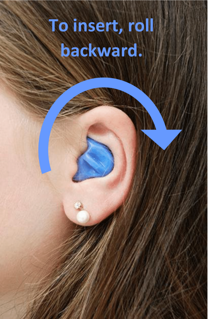 Custom Ear Protection Guide | IMPERIAL MEDICAL CLINIC